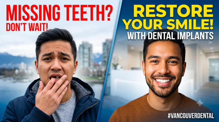 Why a Dental Implant Vancouver Solution Is the Gold Standard for Missing Teeth