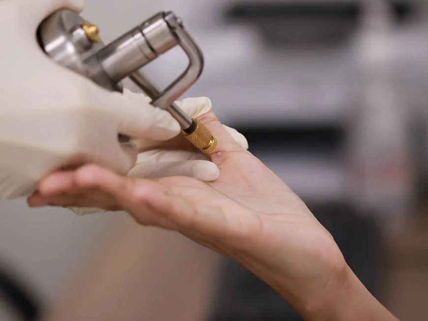 How Many Cryosurgery Sessions Are Typically Needed?
