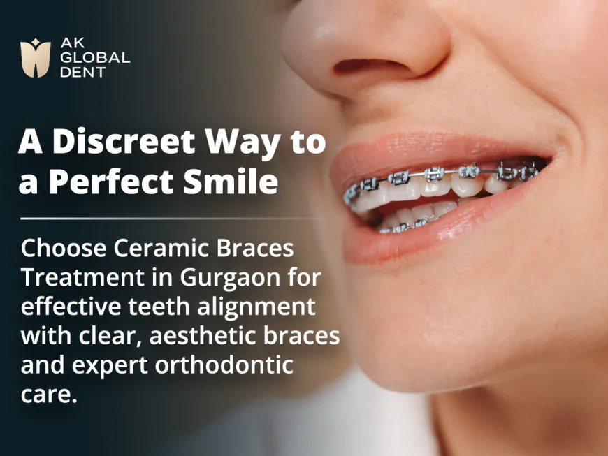 Ceramic Braces Treatment in Gurgaon: A Discreet Way to a Confident Smile