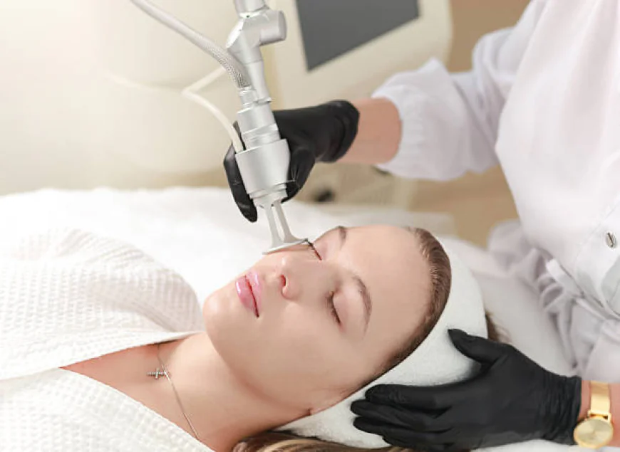 Does Fractional CO2 laser treatment tighten skin