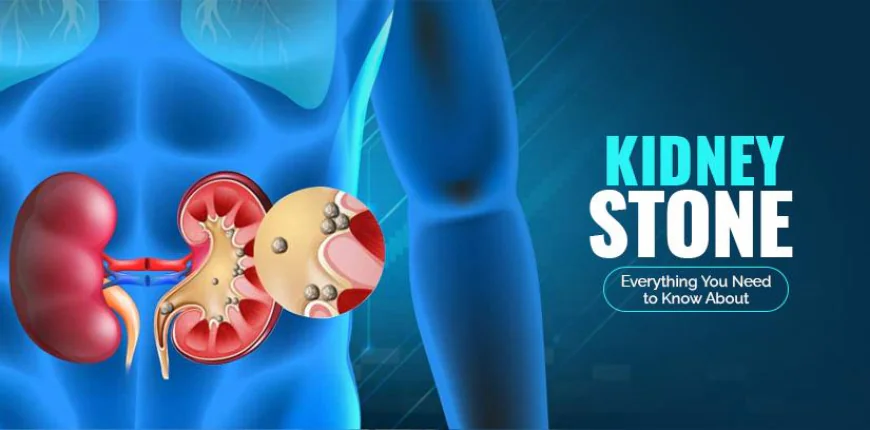 Numerous Benefits Of Laser Treatment For Kidney Stones
