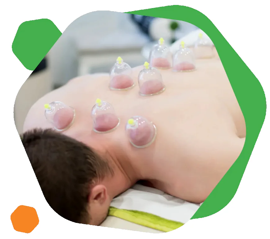 Cosmetic Acupuncture Calgary Treatments for Glowing and Healthy Skin