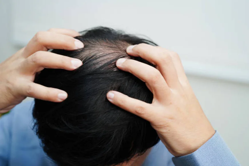 Does GFC Treatment for Hair Stimulate Dormant Follicles?
