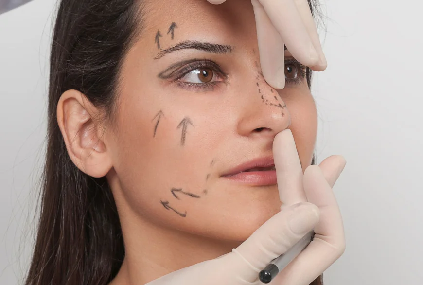 When Do Rhinoplasty Results Become Visible?