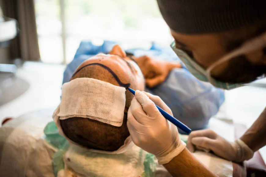 Can Scalp Micropigmentation Hide a Receding Hairline