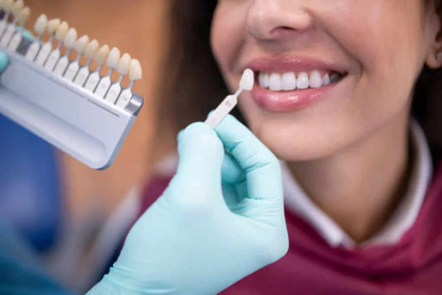 Teeth Whitening in Dubai: What to Expect