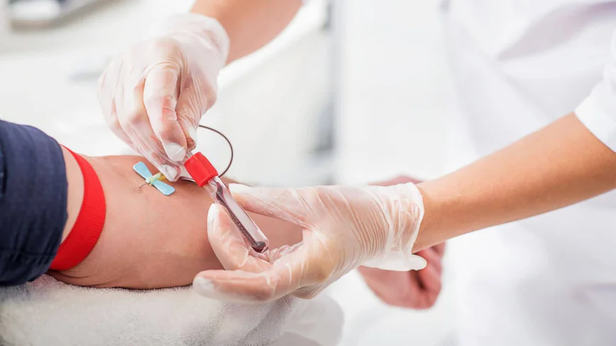 Cortisol Blood Test Dubai: How It Works