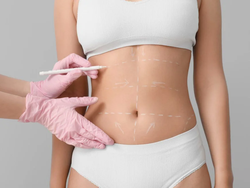 Mini Abdominoplasty in Dubai: Modern Core Makeover
