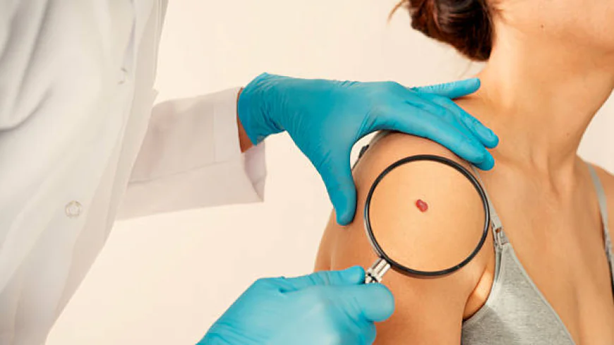How Can Warts Removal Treatment  Improve Wart Care?