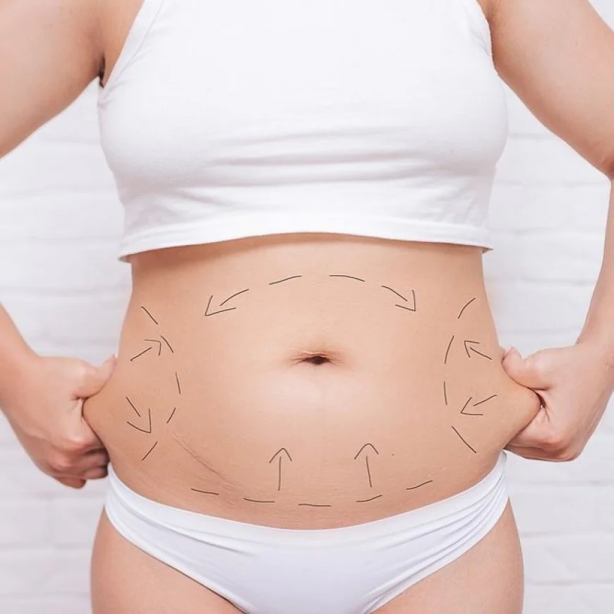 Tummy Tuck in Dubai: Tailored Body Contouring