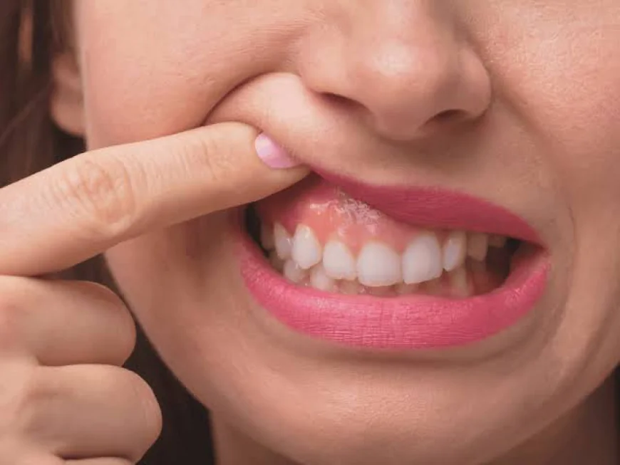Why Is Gum Recession Treatment Recommended?