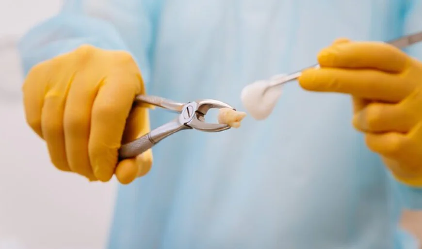 Tooth Extraction: What to Know Before, During and After Treatment