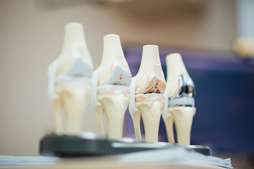 Knee Implants Market Size, Trends, and Strategic Outlook 2026-2033