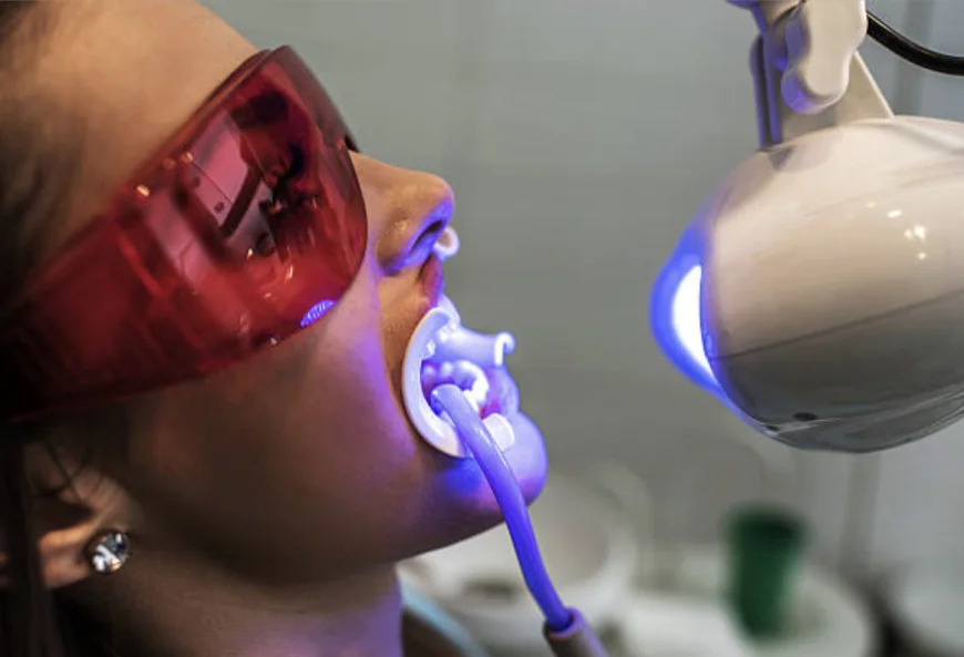 Achieve a Radiant Smile with Philips Zoom Whitening Mount Roskill, Auckland