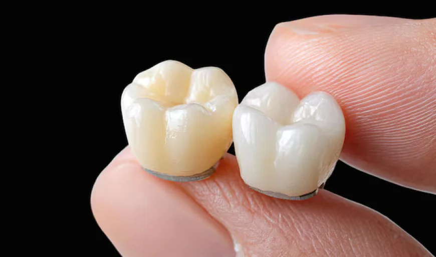 Dental Crowns in Restorative Dentistry Enhance Your Smile and Confidence