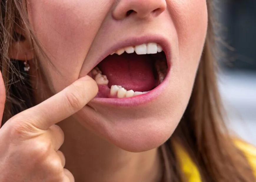 Effective Solutions for Missing Teeth Restoration