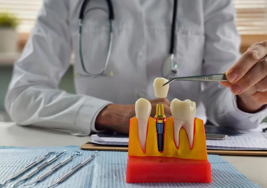 What Should You Know Before Choosing an Implant After Tooth Loss?