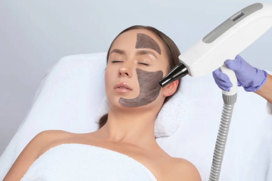 Can Laser Carbon Peel Improve Skin Clarity Quickly?