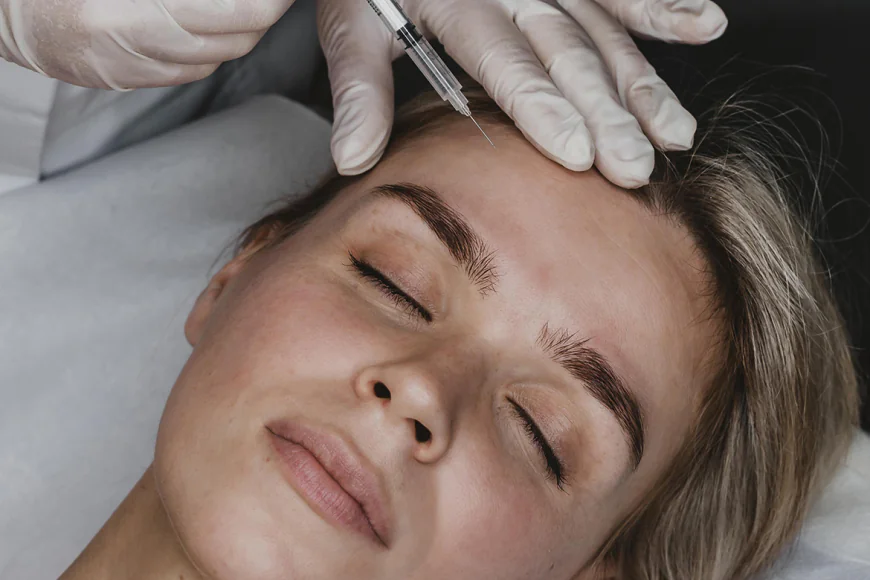 Can Volift Fillers Improve Cheek Contours for a Refined Facial Look?