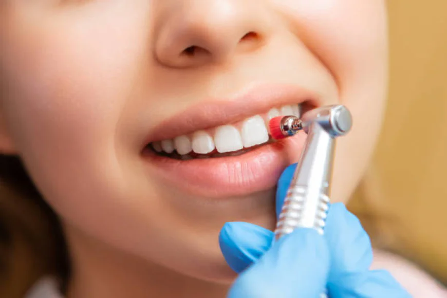Teeth Polishing & Scaling: Complete Guide