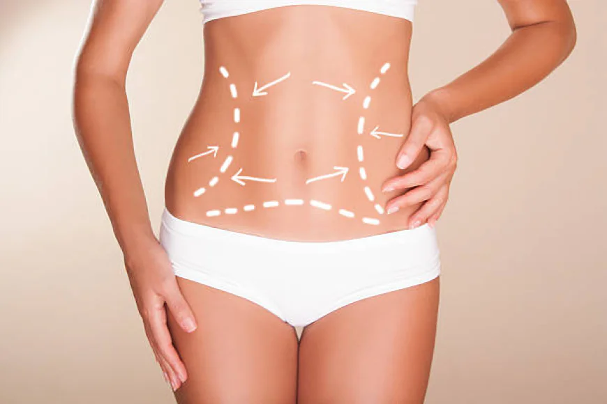 Can Lipo Abdominoplasty create a slimmer waist