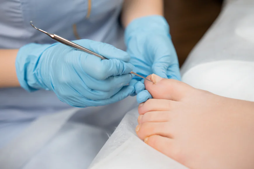 Why Do Ingrown Toenails Happen? Simple Causes and Easy Prevention Tips