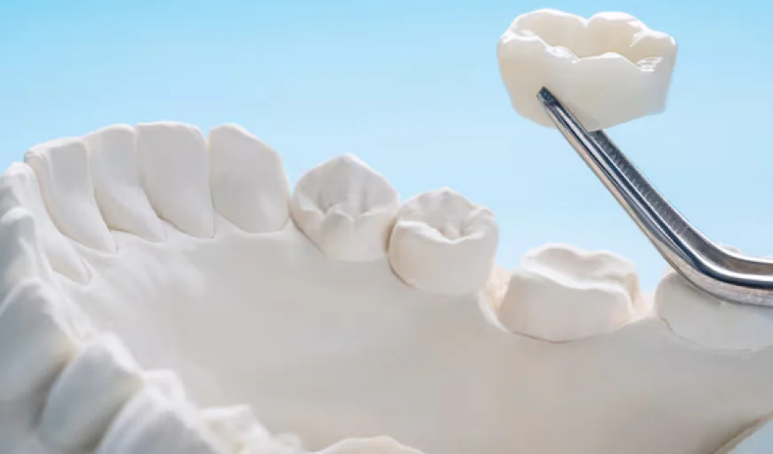Transform Your Smile with Custom Durable Dental Crowns and Procedure