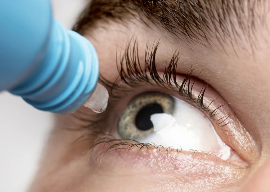 How Long Do Ciprofloxacin Eye Drops Take to Work?