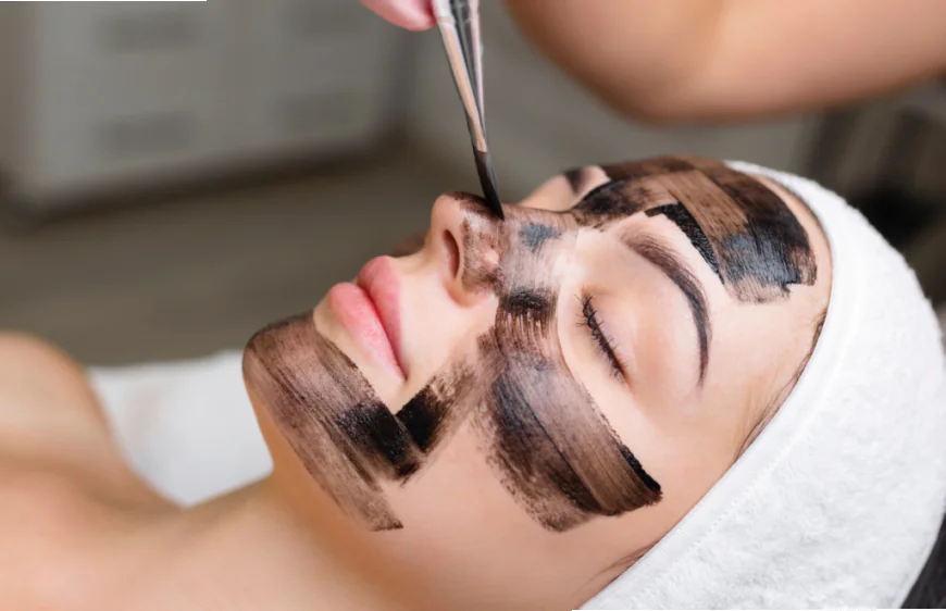 Is Laser Carbon Peel Suitable for Sensitive Skin?