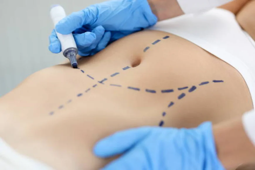 Can Tummy Tuck reshape a sagging lower abdomen