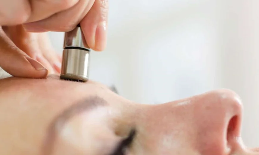 How Does Microdermabrasion Treatment Exfoliate Skin?