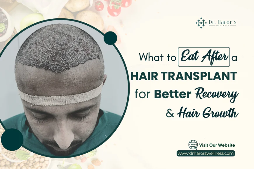 What to Eat After a Hair Transplant for Better Recovery & Hair Growth