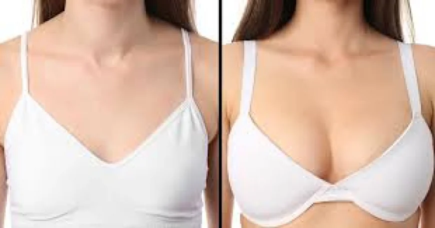 Breast Surgery in Dubai | Questions to Ask Before Treatment