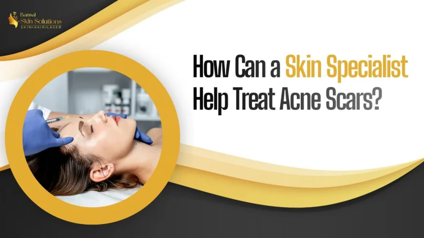 How Can a Skin Specialist Help Treat Acne Scars?