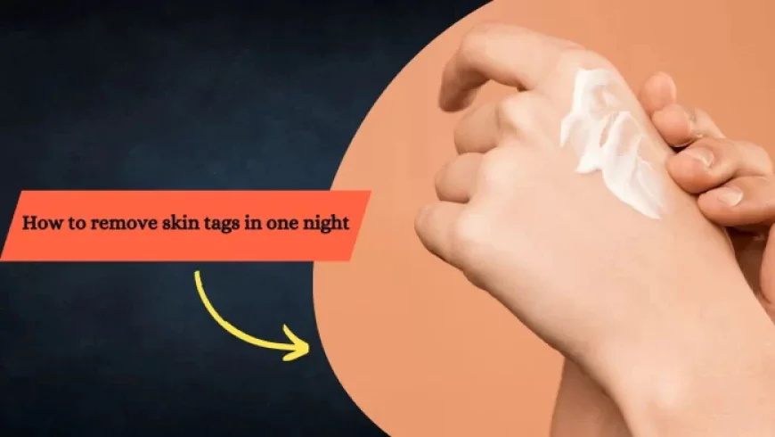 The Truth About Removing Skin Tags in One Night: Separating Fact from Fiction
