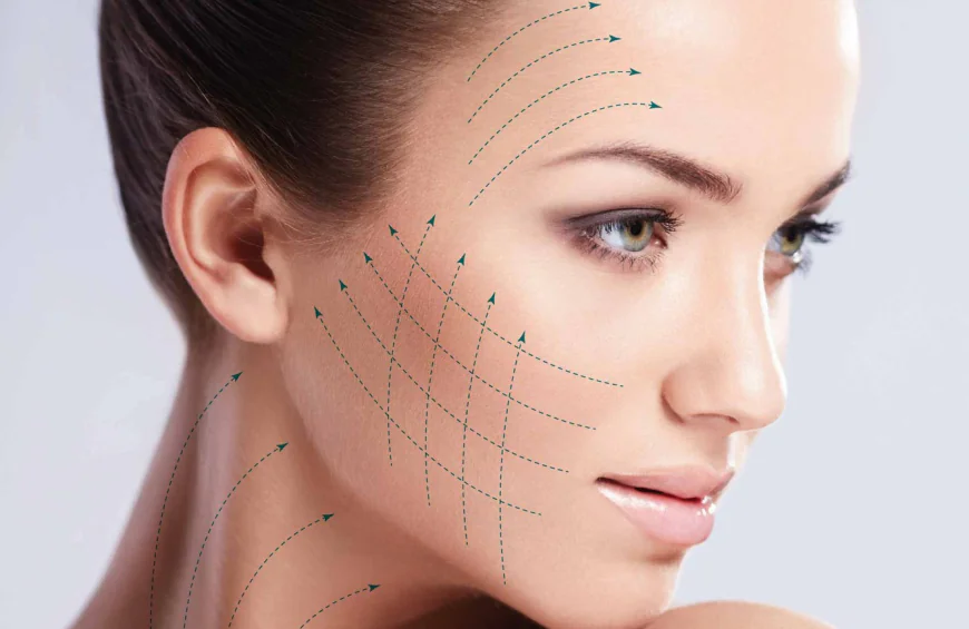 How Long Is a Sugar Thread Lift Procedure