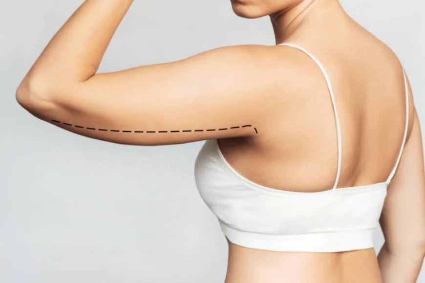How Is an Arm Lift Different From Liposuction