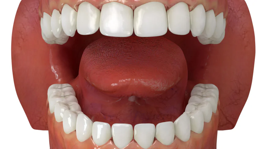 Dental Implants: How Long Can They Last?