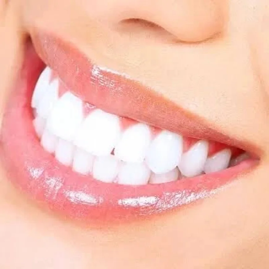 Effective Teeth Whitening Solutions in Dubai & Abu Dhabi | Glamorous Clinic Dubai