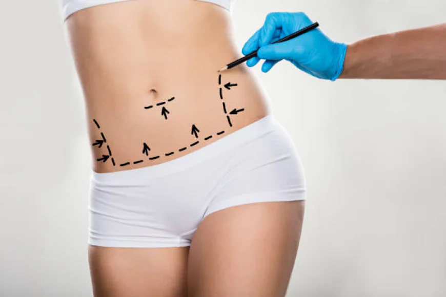 Is Body Lift different from a standard tummy tuck