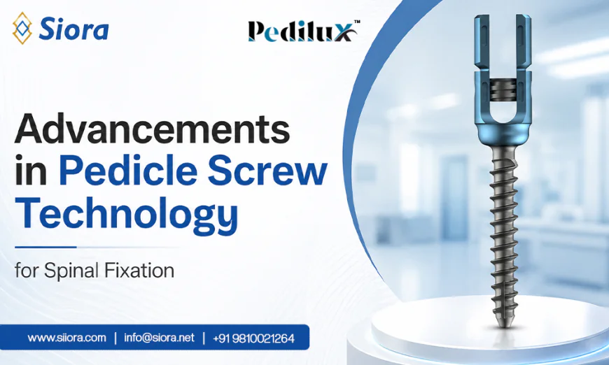 Advancements in Pedicle Screw Technology for Spinal Fixation