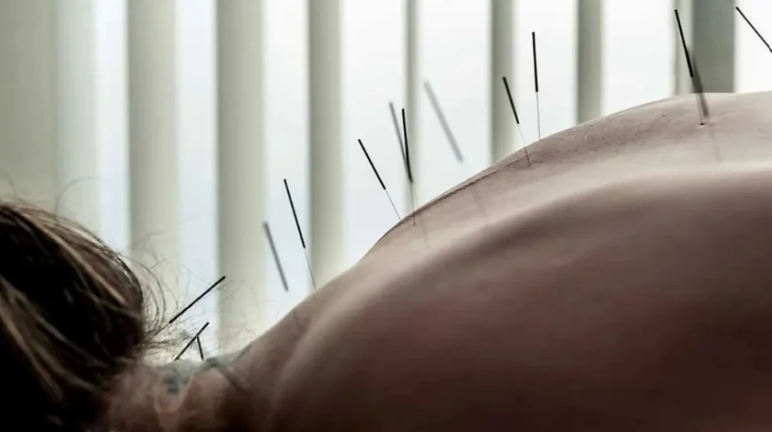 What Acupuncture Can Actually Help With: An Honest Guide
