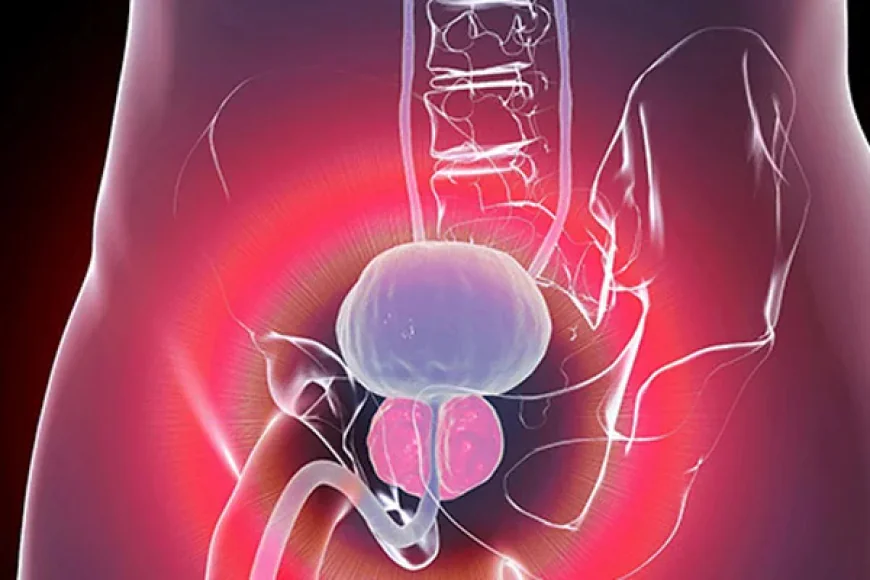 TURP Surgery in Gurgaon: Effective Treatment for Enlarged Prostate