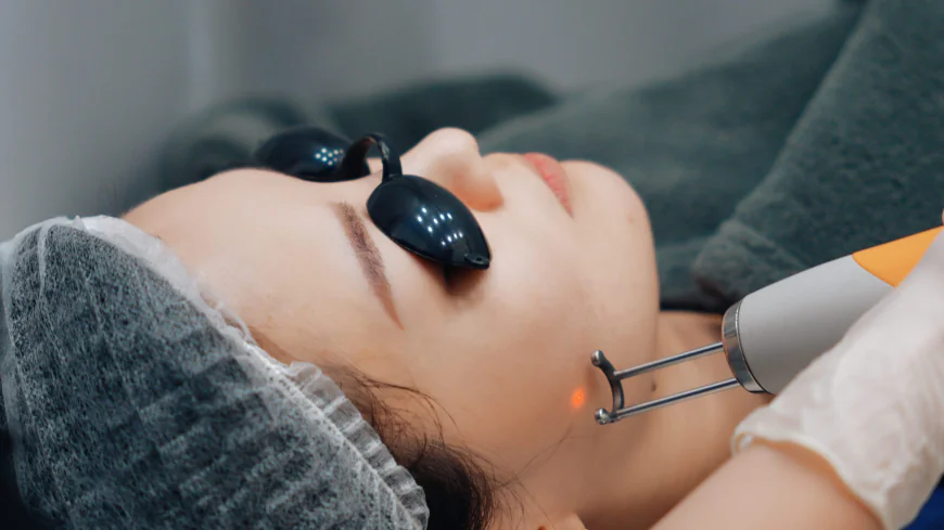 How Does Pico Laser Brighten Skin and Improve Its Glow?