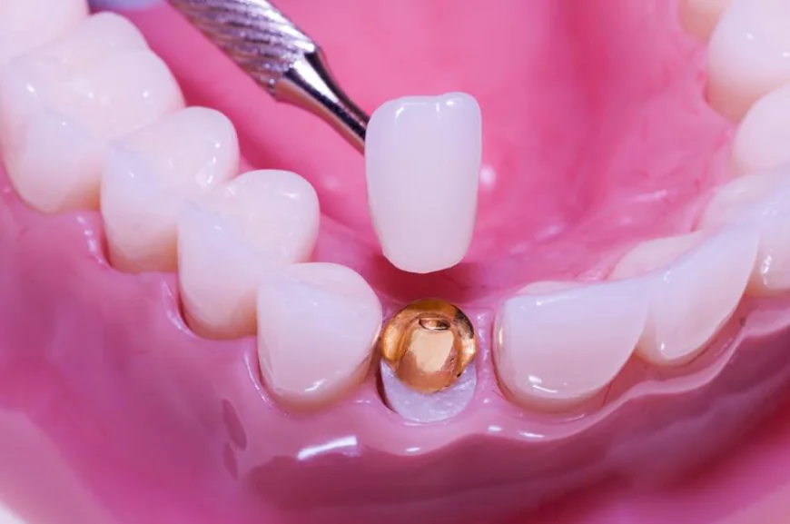 How Modern Dental Care Can Restore and Enhance Your Smile