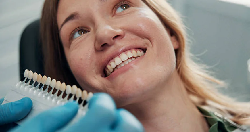 Dental Veneers: Benefits, Types and What to Expect