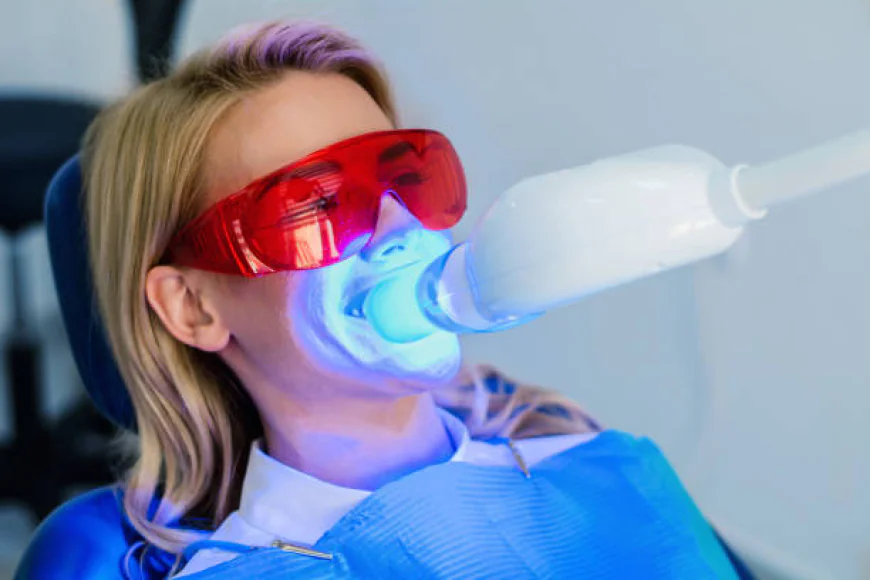 Teeth Whitening: Benefits, Options and What to Expect
