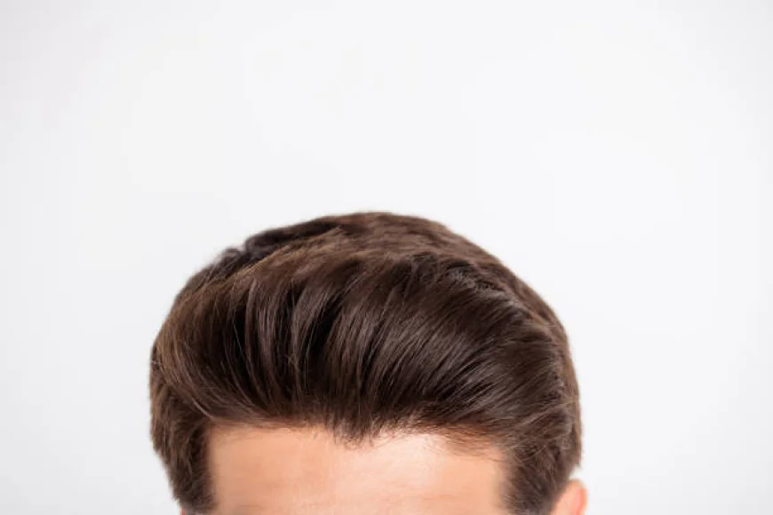Can Hair Transplant Restore a Thinning Hairline?