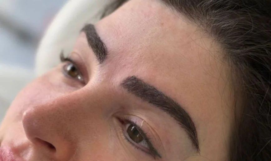 Is Eyebrow Hair Transplant a Good Choice for You?