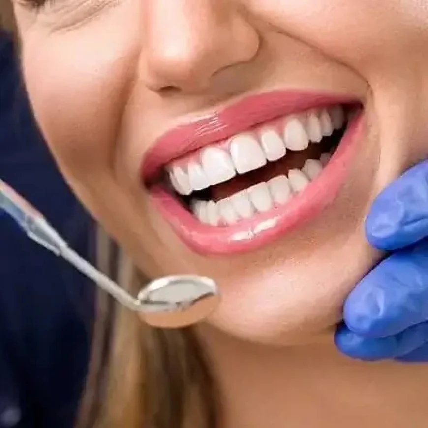 E-Max Veneers in Dubai & Abu Dhabi with Precision Smile Design | Glamorous Clinic Dubai